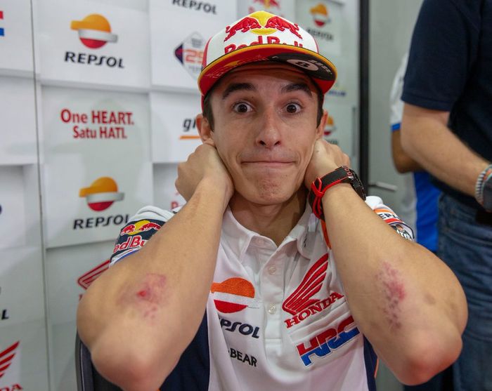 Marc Marquez menunjukkan luka memar di kedua sikunya usai terjatuh di kualifikasi MotoGP Malaysia 2019