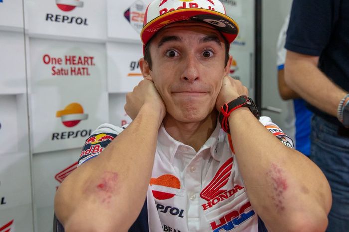 Marc Marquez menunjukkan luka memar di kedua sikunya usai terjatuh di kualifikasi MotoGP Malaysia 2019