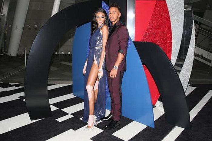 Winnie Harlow dan juara dunia F1 Lewis Hamilton pada sebuah kesempatan di acara fashion