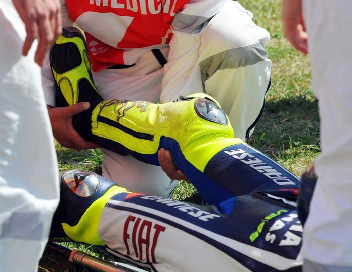 Valentino Rossi mengalami patah tulang dan harus absen di empat balapan